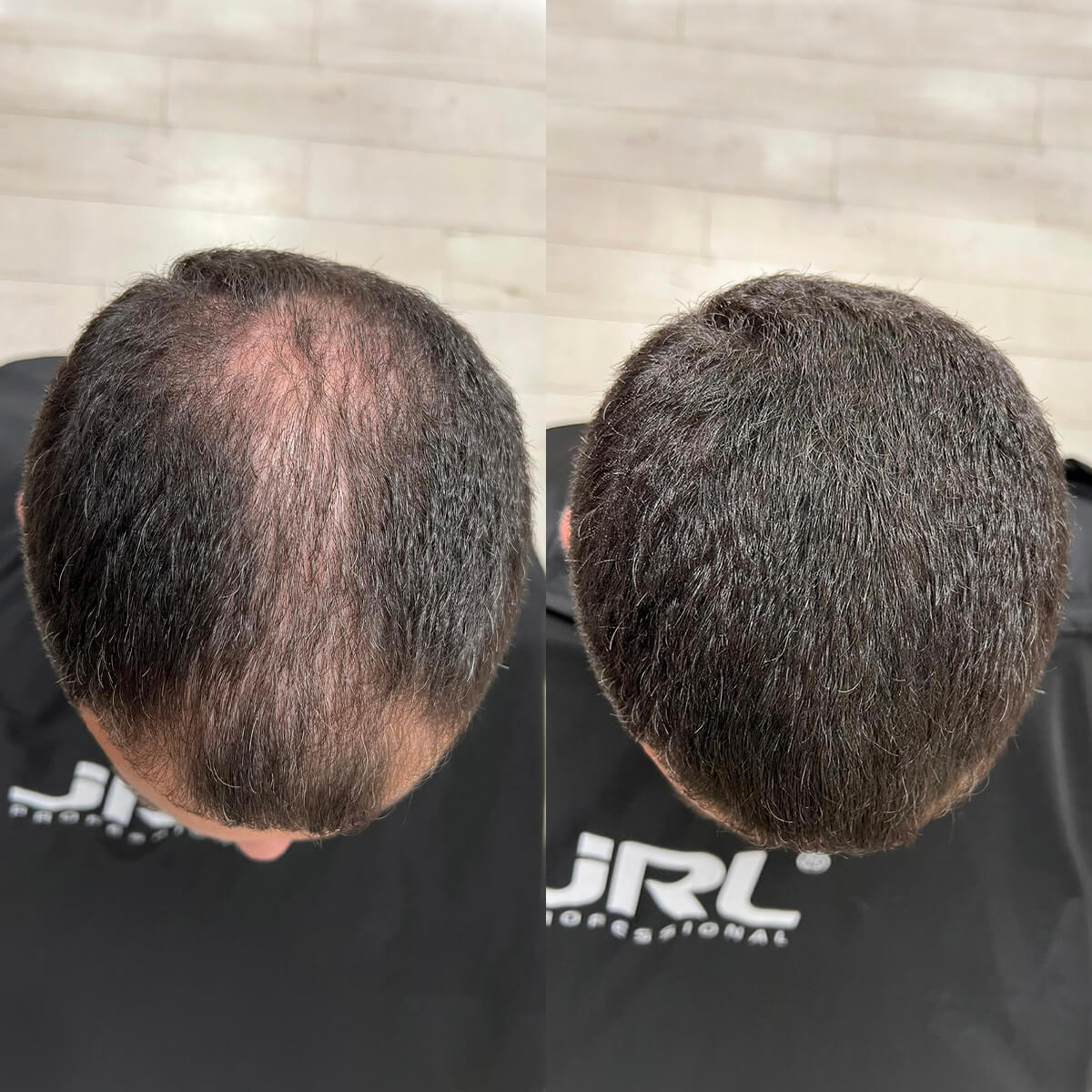 Nanofibre Toppik 55g