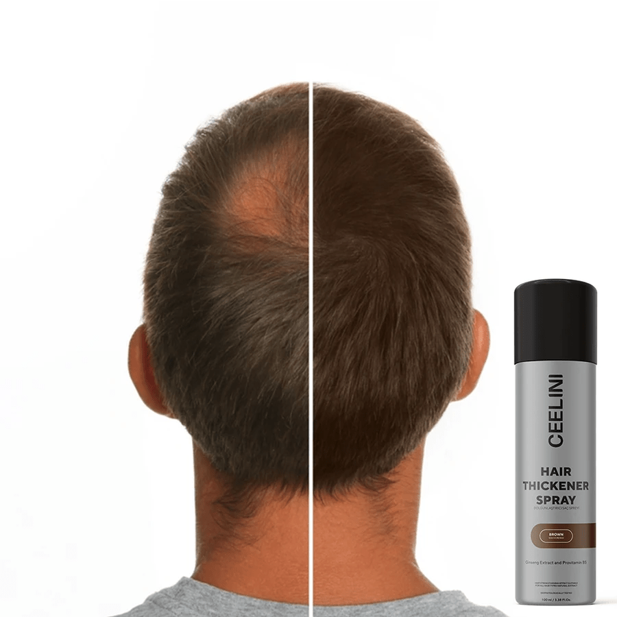 CEELINI – Spray pentru Îndesirea Părului cu Fibre – 100ml - | VrajaDulce