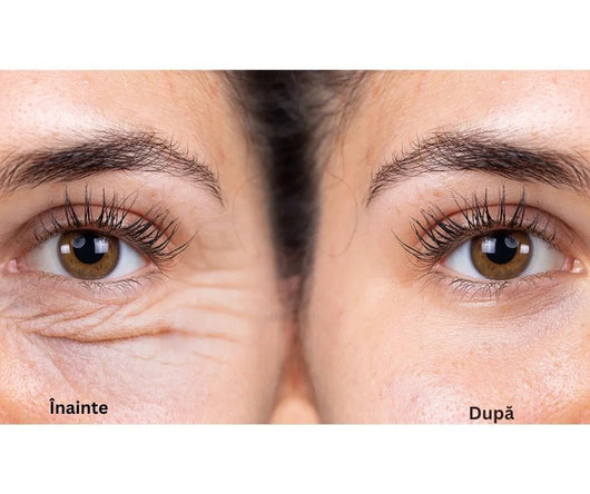 Cremă Anti - Rid cu Venin de Albină Sadoer – Fermitate & Hidratare Intensă - crema | VrajaDulce