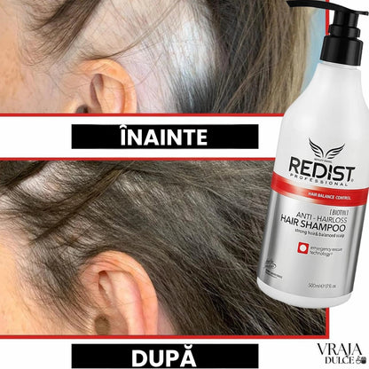 Șampon Redist Anti - Cădere 500ml – Întărire Firului de Păr și Hidratare Scalp - Sampon | VrajaDulce